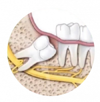 denti (1)